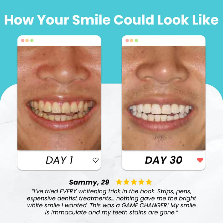 IVLARA Zensmile Brush
